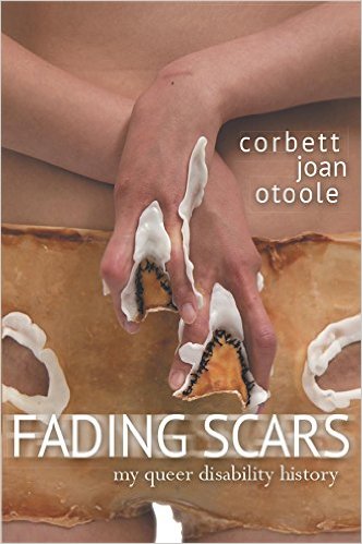 Book cover, corbett joan otoole FADING SCARS my queer disability history, two crip hands form upside down Vs over a scarred pelvis.